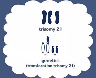 唐氏综合症的原因，孩子为什么会得唐氏综合症