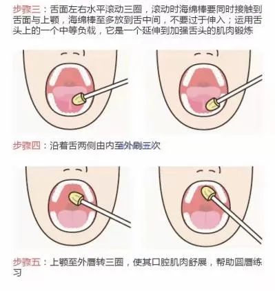 用海绵棒轻轻刷孩子的嘴唇